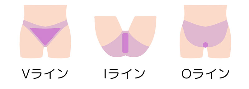VIO