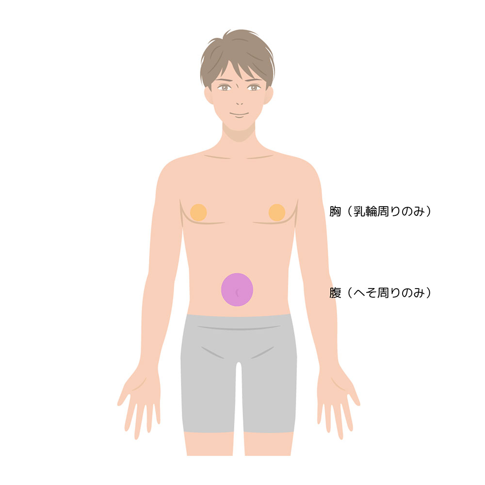 Sパーツ